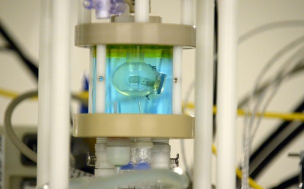 Pixium Vision: à l’aube de l’’oeil bionique